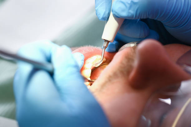 Best Emergency Treatment for Oral Infections in Wilmer, TX