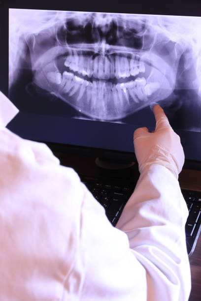 Best Emergency Root Canal Therapy in Wilmer, TX