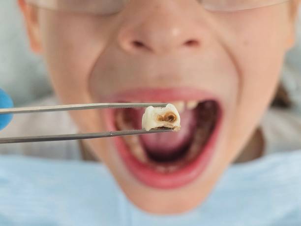 Best Emergency Treatment for Jaw Pain or Injury in Wilmer, TX